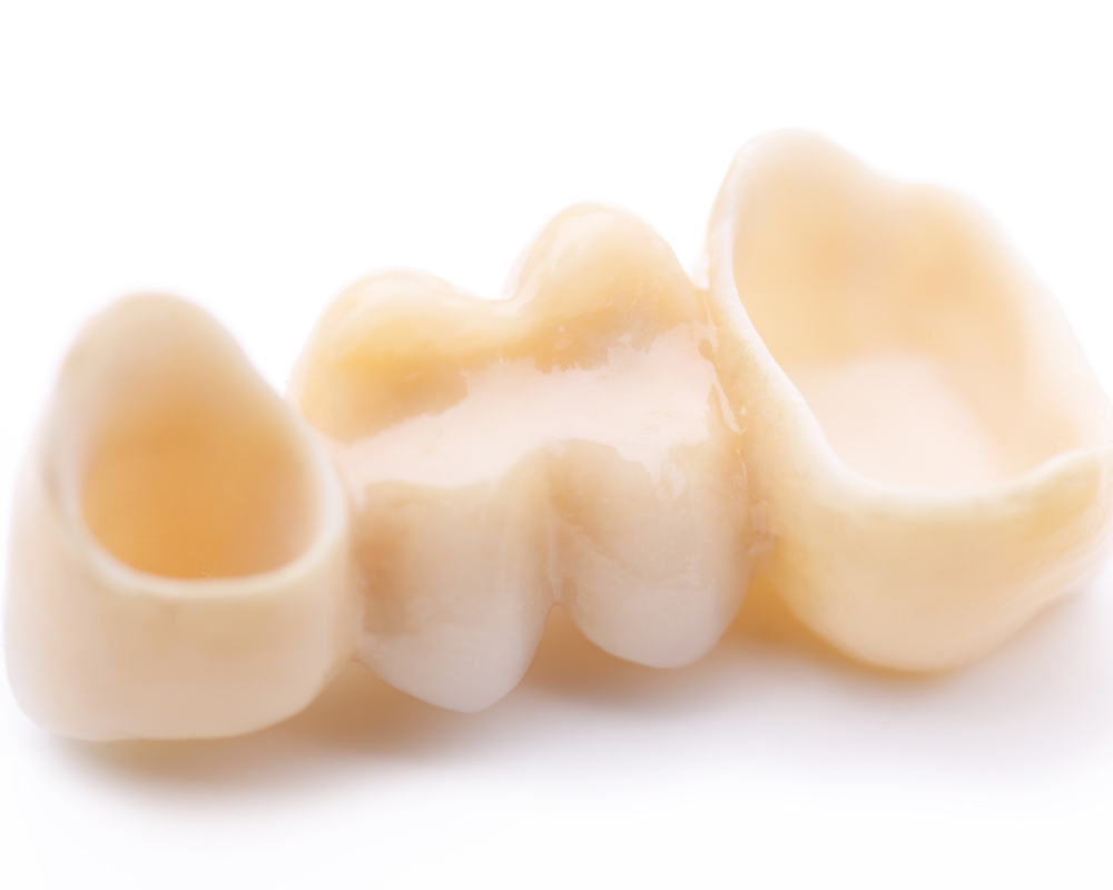 What are dental crowns made of