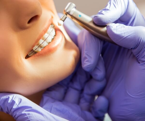  Orthodontics