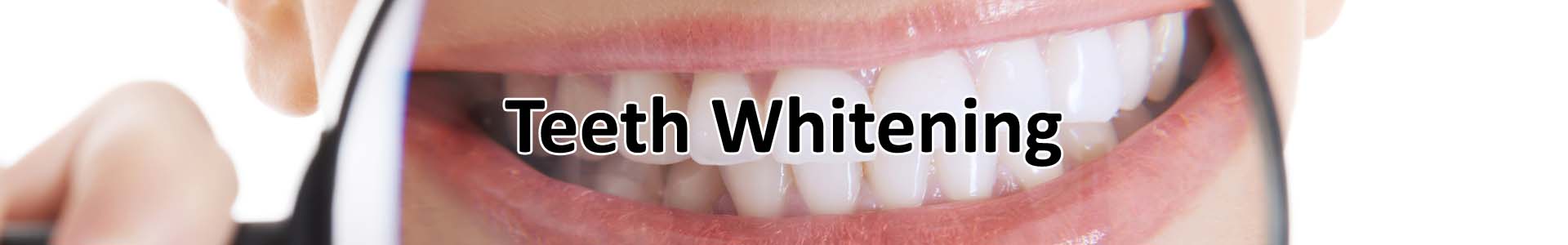 Teeth Whitening - Smiles by Rangel Visalia