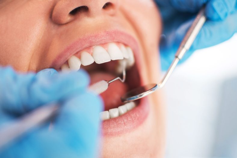 Dental check-up